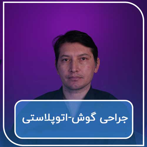 جراحی گوش اتوپلاستی