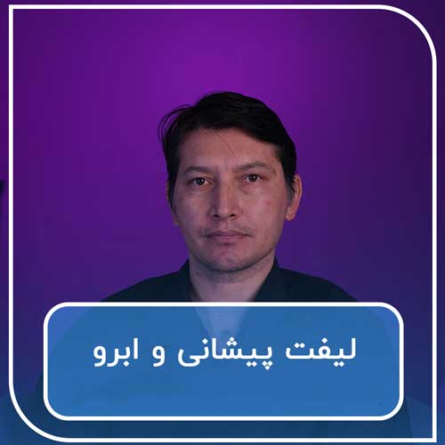 لیفت پیشانی و ابرو
