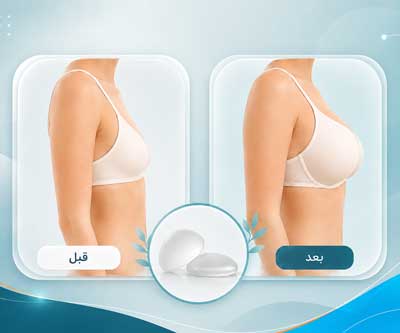 عکس های قبل و بعد پروتز سینه